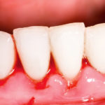 Higiene dental en Badal