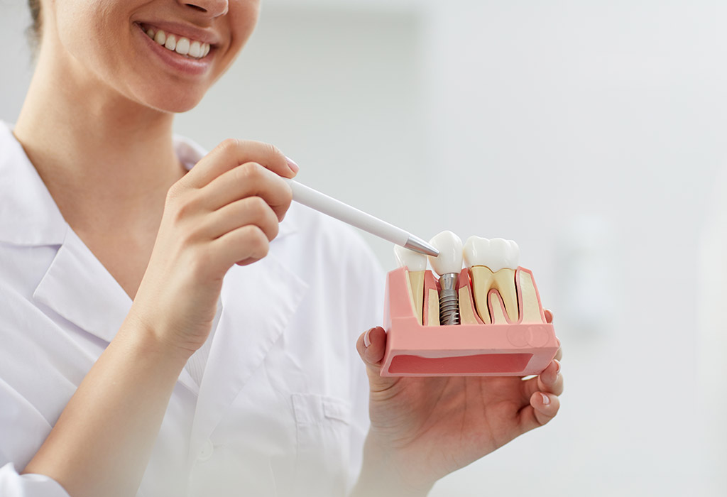Implantes dentales de carga inmediata en Cerdanyola